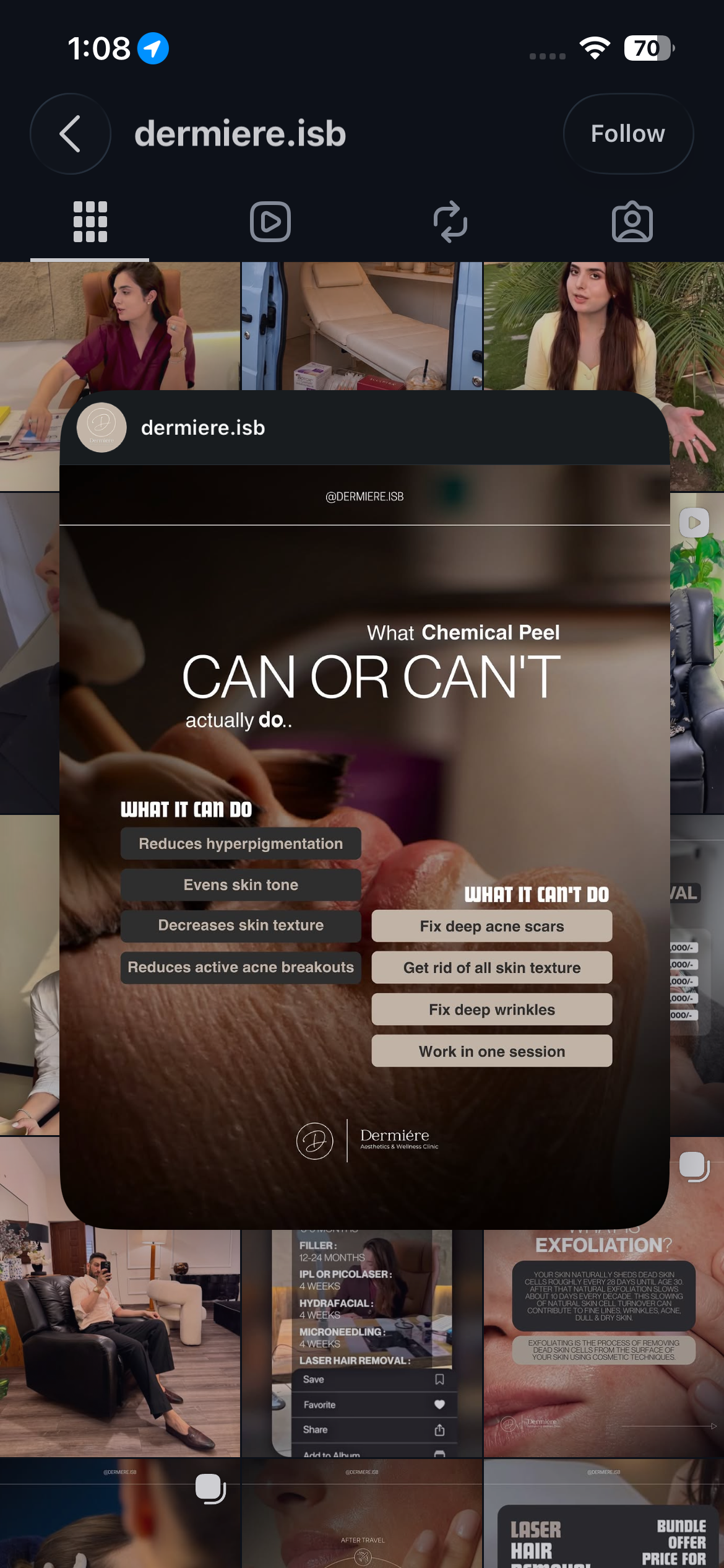Default image